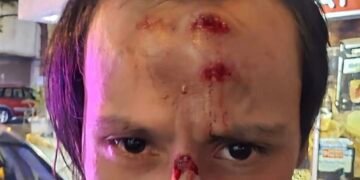გლოვოს კურიერს თავს დაესხნენ